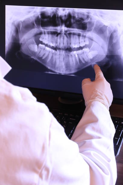Best Knocked-Out Tooth (Avulsed Tooth) Treatment in Fannett, TX
